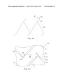 FASTENING SYSTEM diagram and image