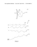 METHOD FOR DISPLAYING CATHETER ELECTRODE-TISSUE CONTACT IN     ELECTRO-ANATOMIC MAPPING AND NAVIGATION SYSTEM diagram and image