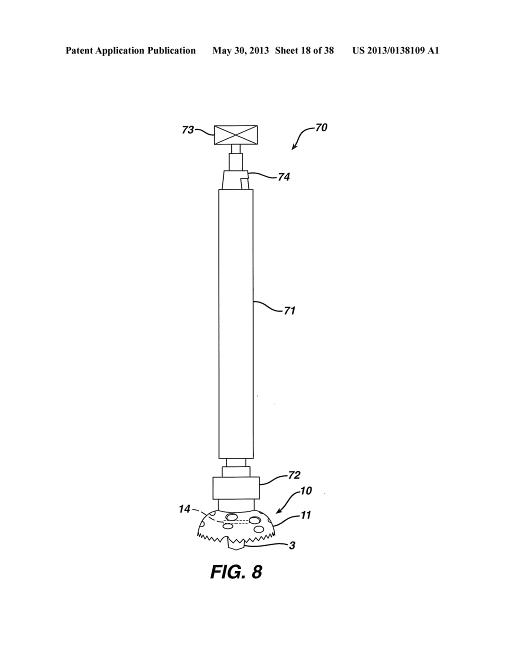 Arthroplasty Instruments and Associated Method - diagram, schematic, and image 19