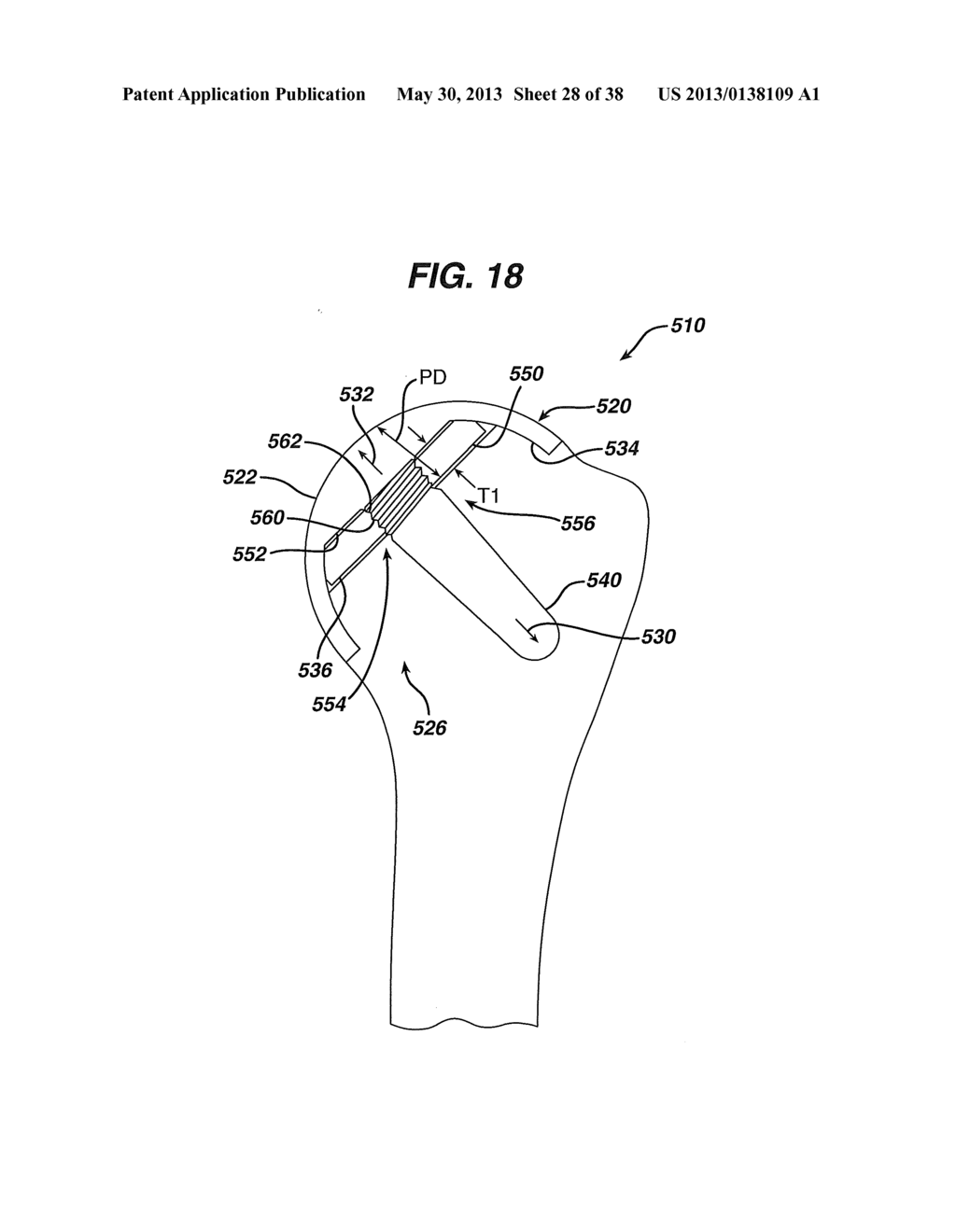 Arthroplasty Instruments and Associated Method - diagram, schematic, and image 29