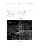 DEVICES FOR ADAPTING BONE diagram and image