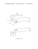 Methods And Devices For Endoscopically Creating An Anastomosis diagram and image