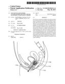 STENT DEVICES FOR SUPPORT, CONTROLLED DRUG DELIVERY AND PAIN MANAGEMENT     AFTER VAGINAL SURGERY diagram and image