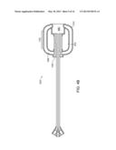 STENT DEVICES FOR SUPPORT, CONTROLLED DRUG DELIVERY AND PAIN MANAGEMENT     AFTER VAGINAL SURGERY diagram and image