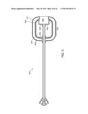 STENT DEVICES FOR SUPPORT, CONTROLLED DRUG DELIVERY AND PAIN MANAGEMENT     AFTER VAGINAL SURGERY diagram and image