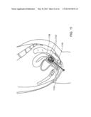 STENT DEVICES FOR SUPPORT, CONTROLLED DRUG DELIVERY AND PAIN MANAGEMENT     AFTER VAGINAL SURGERY diagram and image