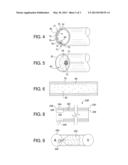 HEMODIALYSIS GRAFT diagram and image