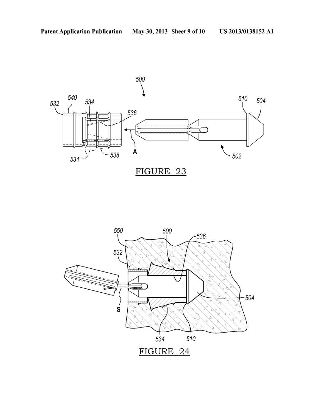 Method And Apparatus For Suture Anchors With A Vertical Eyelet - diagram, schematic, and image 10