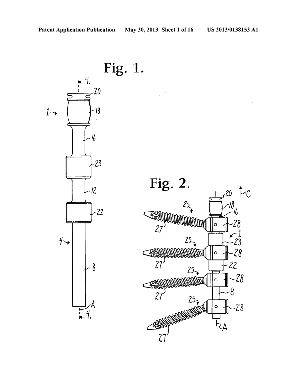 Dynamic stabilization assembly having pre-compressed spacers with     differential displacements - diagram, schematic, and image 02