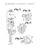 Polyaxial bone anchor having an open retainer with conical, cylindrical or     curvate capture diagram and image