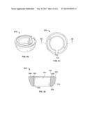 Polyaxial bone anchor having an open retainer with conical, cylindrical or     curvate capture diagram and image