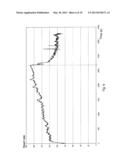 ACTIVITY-RESPONSIVE PACING diagram and image