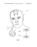 BRAIN STIMULATION PROGRAMMING diagram and image