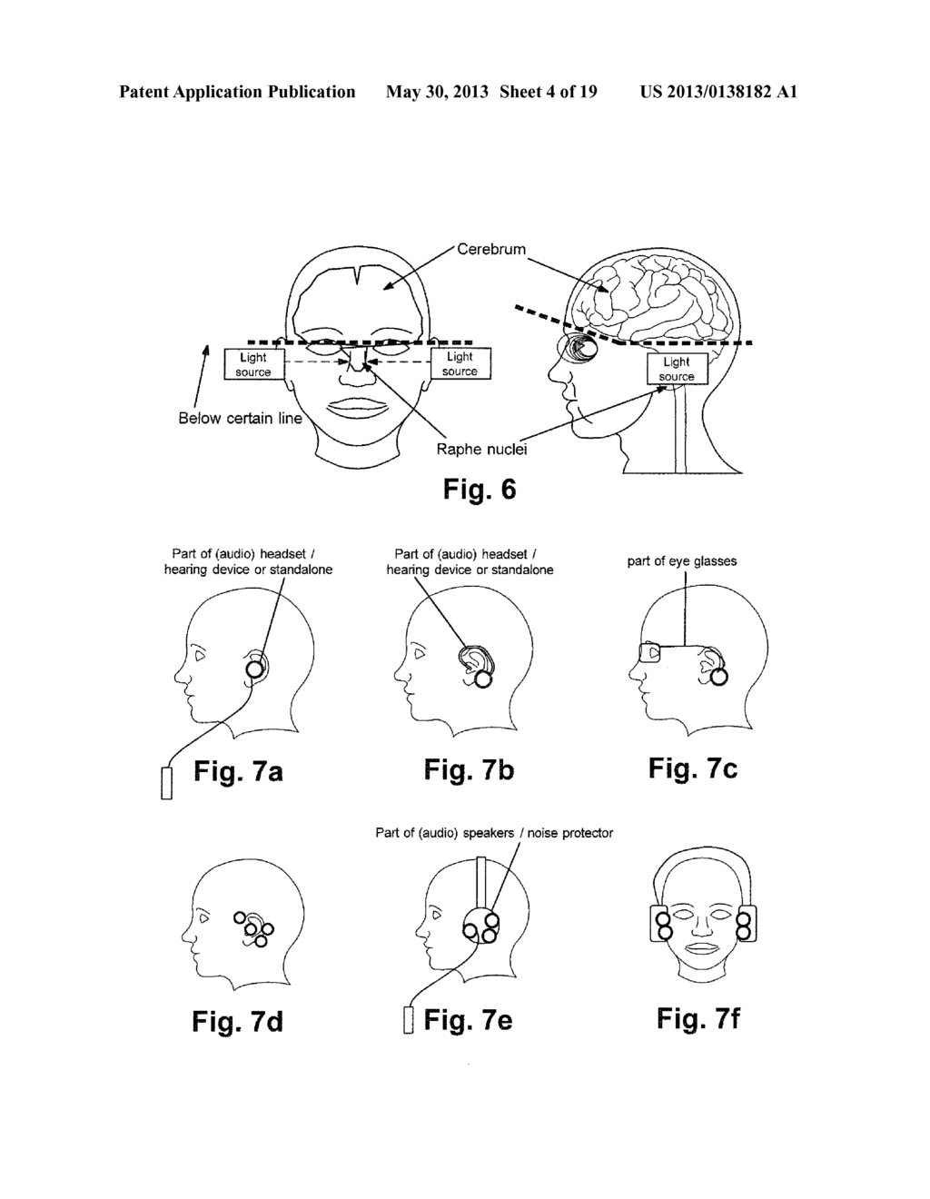 DEVICE AND METHOD FOR ALTERING NEUROTRANSMITTER LEVEL IN BRAIN - diagram, schematic, and image 05