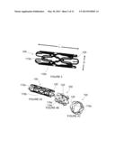 Prosthesis having a plurality of distal and proximal prongs diagram and image