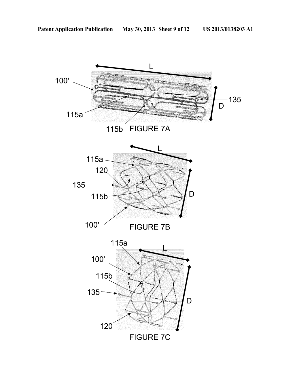 Prosthesis having a plurality of distal and proximal prongs - diagram, schematic, and image 10