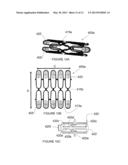 Prosthesis having a plurality of distal and proximal prongs diagram and image