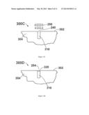 MEDICAL DEVICE FOR BONE IMPLANT AND METHOD FOR PRODUCING SUCH A DEVICE diagram and image