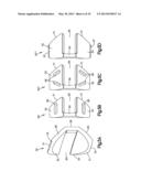 Intervertebral Implant with Blades for Connecting to Adjacent Vertebral     Bodies diagram and image