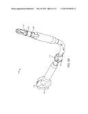SURGICAL METHODS AND INSTRUMENTS FOR IMPLANTING A JOINT UNLOADING SYSTEM diagram and image