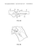 SURGICAL METHODS AND INSTRUMENTS FOR IMPLANTING A JOINT UNLOADING SYSTEM diagram and image