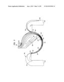 AERODYNAMIC SEPARATION NOZZLE diagram and image