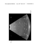 ULTRASOUND PHANTOM HAVING A CURVED SURFACE diagram and image