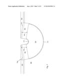 ULTRASOUND PHANTOM HAVING A CURVED SURFACE diagram and image