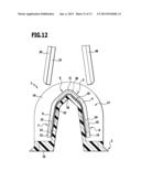 SURGICAL CLIP CARTRIDGE AND HOUSING MEMBER FOR USE THEREIN diagram and image