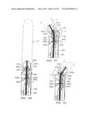 Surgical Stapling Apparatus Including Sensing Mechanism diagram and image