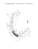 BOTTLE HOLDER FOR MOBILE MEDICAL DEVICE diagram and image