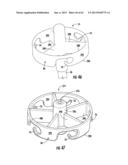 BOTTLE HOLDER FOR MOBILE MEDICAL DEVICE diagram and image