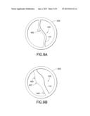 MICROSENSOR FOR MERCURY diagram and image