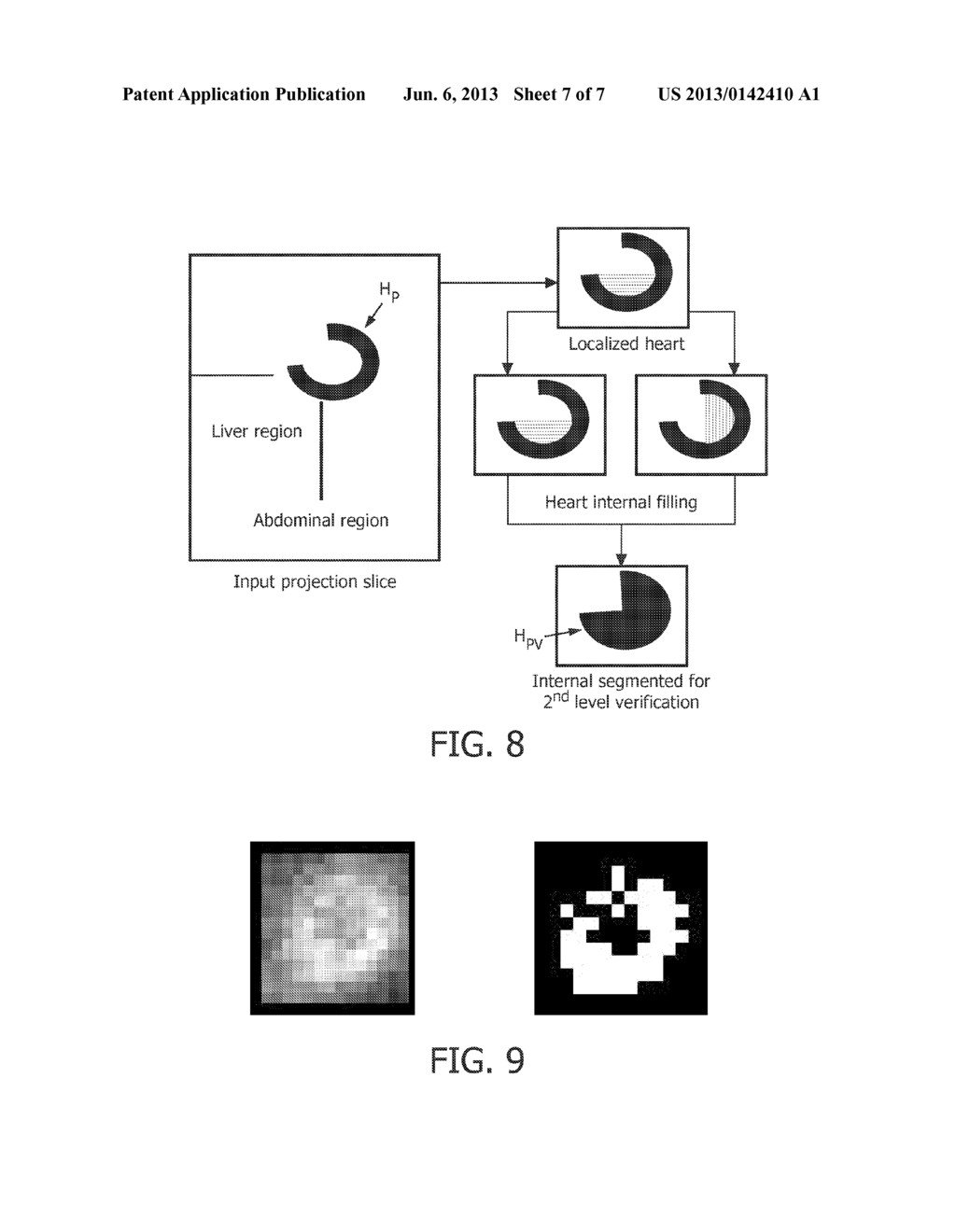 HEART LOCATION AND VERIFICATION IN EMISSION IMAGES - diagram, schematic, and image 08