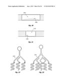 MICROFLUIDIC APPARATUS AND METHODS FOR PERFORMING BLOOD TYPING AND     CROSSMATCHING diagram and image