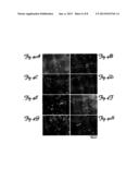 METHODS AND COMPOSITIONS FOR TREATING BRAIN DISEASES diagram and image