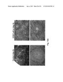 ANTI-ICOS ANTIBODIES AND THEIR USE IN TREATMENT OF ONCOLOGY,     TRANSPLANTATION AND AUTOIMMUNE DISEASE diagram and image