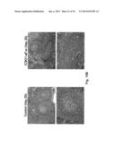 ANTI-ICOS ANTIBODIES AND THEIR USE IN TREATMENT OF ONCOLOGY,     TRANSPLANTATION AND AUTOIMMUNE DISEASE diagram and image