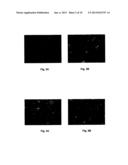 METHOD OF TREATING VIRUS-INDUCED CANCER diagram and image