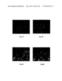 METHOD OF TREATING VIRUS-INDUCED CANCER diagram and image