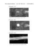 PREPARATION FOR TREATMENT OF SPINAL CORD INJURY diagram and image