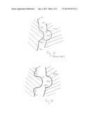 ABUTMENT INLAY diagram and image