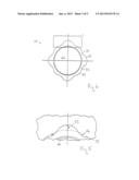 ABUTMENT INLAY diagram and image