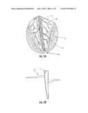 PERIODONTAL TREATMENT SYSTEM AND METHOD diagram and image