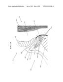 PERIODONTAL TREATMENT SYSTEM AND METHOD diagram and image