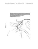 PERIODONTAL TREATMENT SYSTEM AND METHOD diagram and image