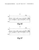 HIGHLY SENSITIVE METHOD FOR DETECTION OF VIRAL HIV DNA REMAINING AFTER     ANTIRETROVIRAL THERAPY OF AIDS PATIENTS diagram and image