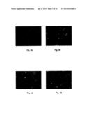 METHOD OF PRODUCING THE POLYPEPTIDE FOR TREATING VIRUS-INDUCED CANCER diagram and image