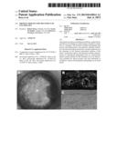 Protein Therapy for Treatment of Eye Diseases diagram and image