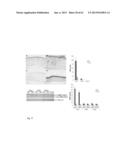 Protein Therapy for Treatment of Eye Diseases diagram and image